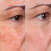 Rejuvenate Face Serum, Rejuvenate Resurfacing Skin Care Face Serum, Rejuvenation, Anti Wrinkle and Remove