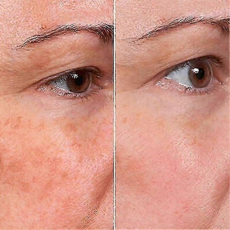 Rejuvenate Face Serum, Rejuvenate Resurfacing Skin Care Face Serum, Rejuvenation, Anti Wrinkle and Remove