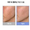 MEDIB Melasma & Dark Spot Remover Cream – Dual Pack (30g X 2)
