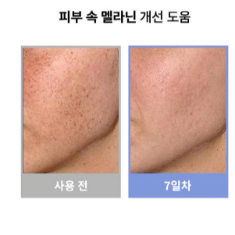 MEDIB Melasma & Dark Spot Remover Cream – Dual Pack (30g X 2)
