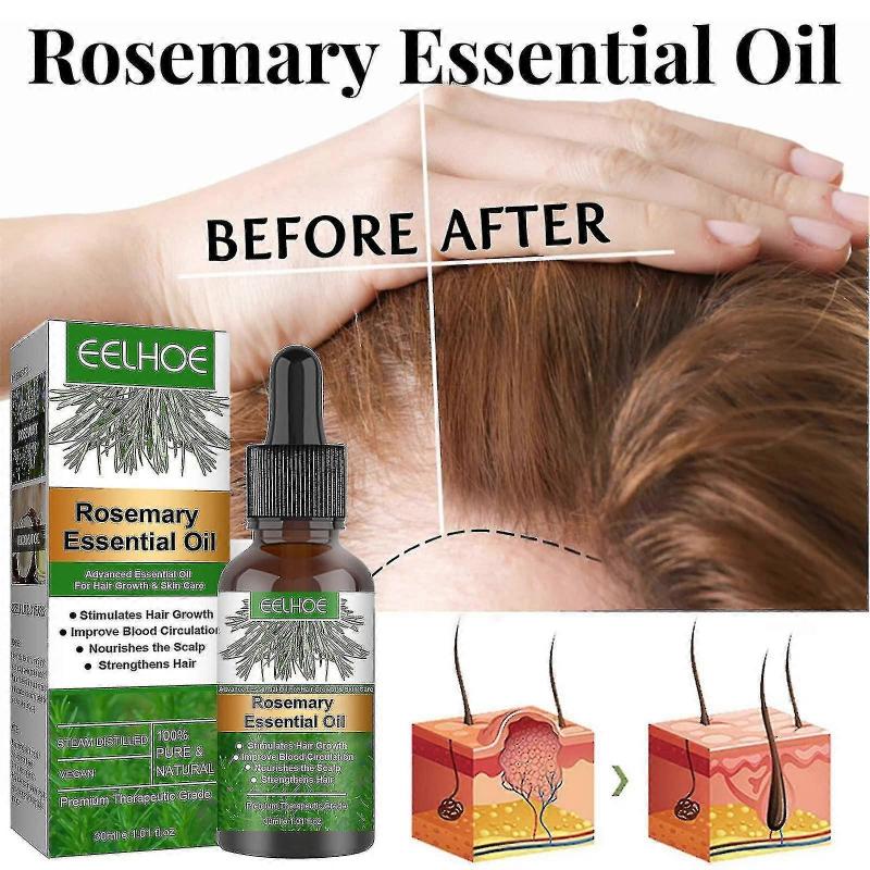 2pcs Rosemary Oil For Hair Growth,rosemary Essential Oil For Hair Growth & Skin Care,improve Hair Loss And Nourishes