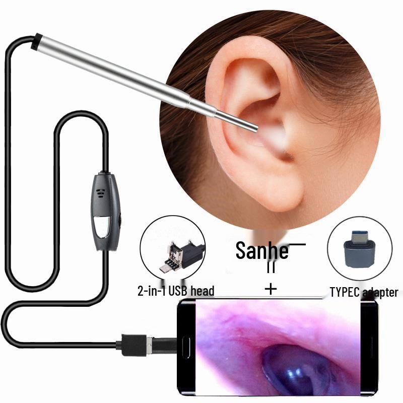Spot HD 720P Visual Ear Spoon Endoscope - Otoscope for Ear, Nose, and Throat Exams