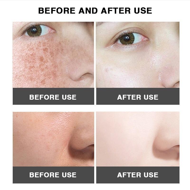 Whitening Cream  Fade Spots Blackheads Melanin Moisturizing Brightening Soft Smooth Firming Skin Care
