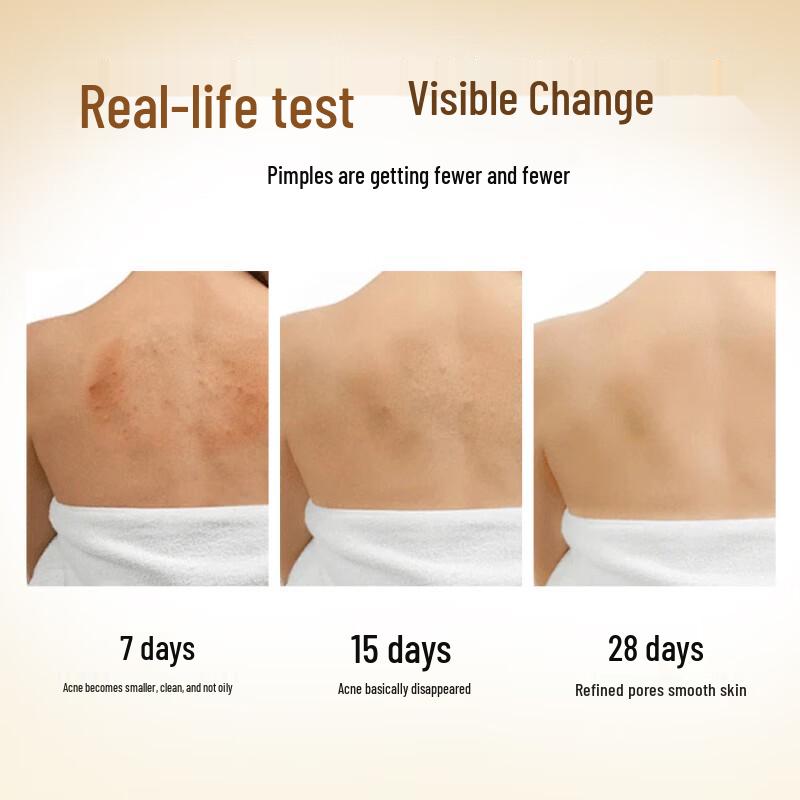 Tongrentang Sulfur Mite Removal Shower Gel