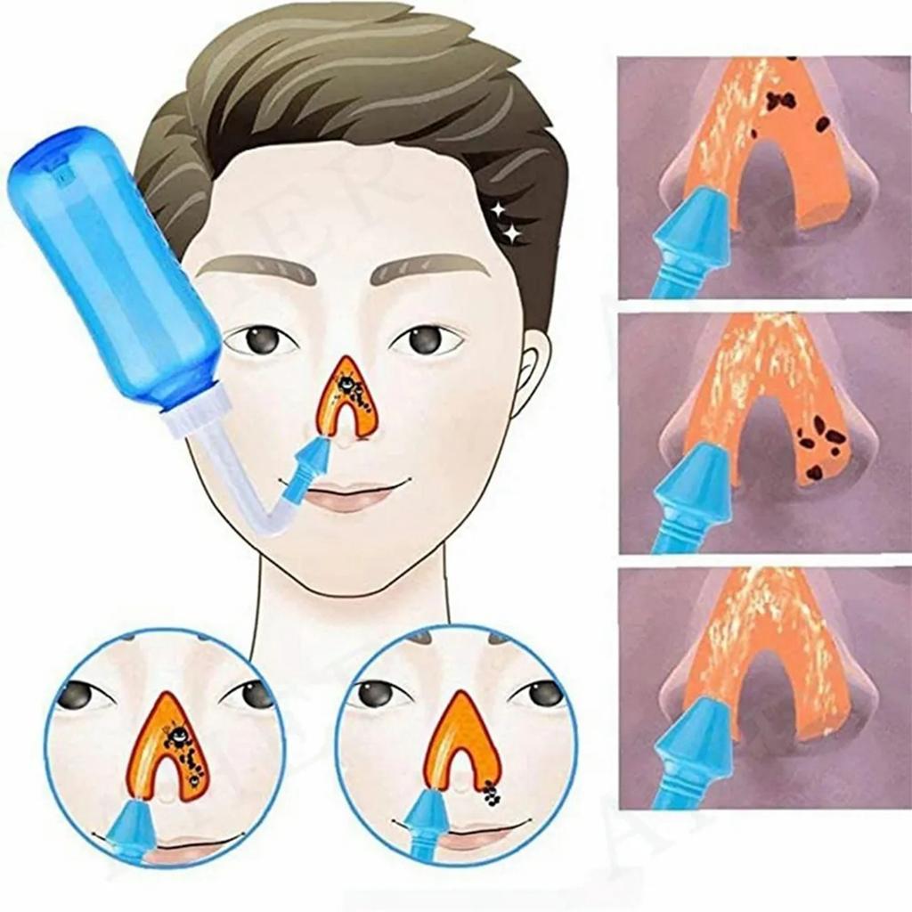 300ml Nose Rinse Bottle Food Grade Washing Nasal Irrigation System Cleaner for Adult Children