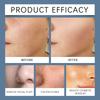 Facial Hair Removal Wax Paper Set, Facial Smooth Hair Removal Wax Strips,5ml