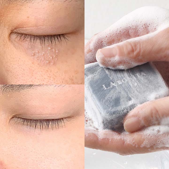 

Labonita Recover AC Tea Tree Soap