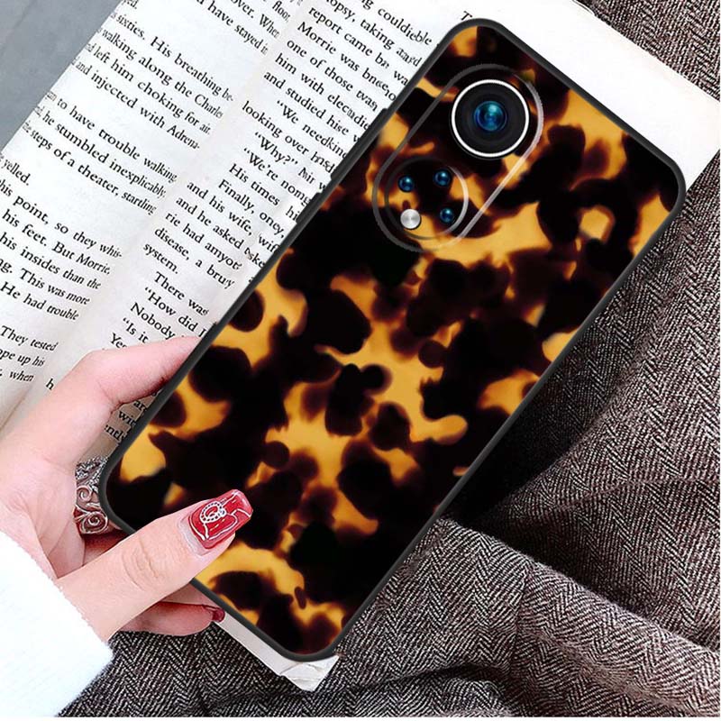 Tortoise Shell Pattern Case For Honor Magic 5 Lite 6 Pro 50 70 90 Honor X8b X9b X6 X7 X8 X9 X6a X7a X8a X9a Cover