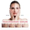 Hoygi Niacinamide Serum Firming & Hydrating Pores Fades Acne Marks & Fine Lines Brightens Skin & Reduces Dark Spots 30ml
