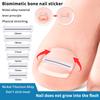 2Pcs Nail Correction Stickers Ingrown Toenail Corrector Patches Paronychia Treatment Recover Corrector Pedicure Tools Foot Care
