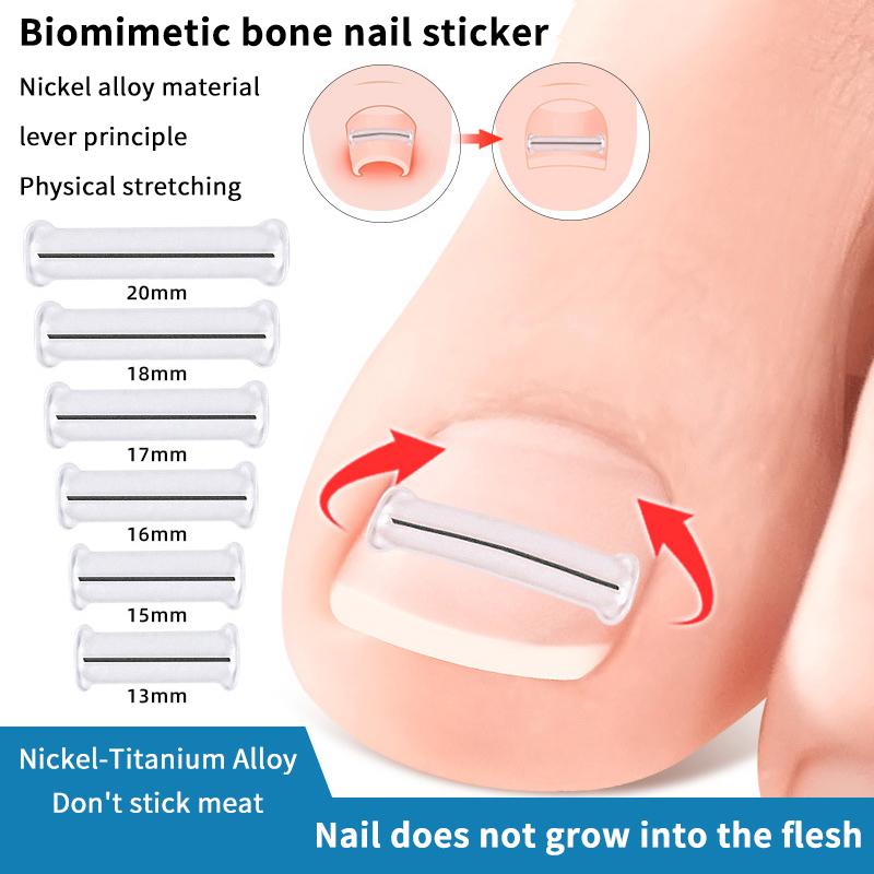 2Pcs Nail Correction Stickers Ingrown Toenail Corrector Patches Paronychia Treatment Recover Corrector Pedicure Tools Foot Care