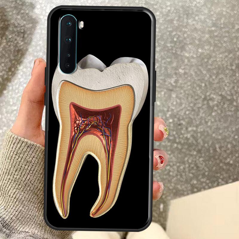 Human Tooth Anatomy Case For OnePlus 13T 10T 8T 10 Pro 15 13 12 11 15R 13R 12R Nord CE 5 2 3 4 Lite N20 N30 Coque