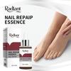 RadiantVita 25ml Nail Serum with Mini Nail File for Nail Care & Manicure - Best Seller