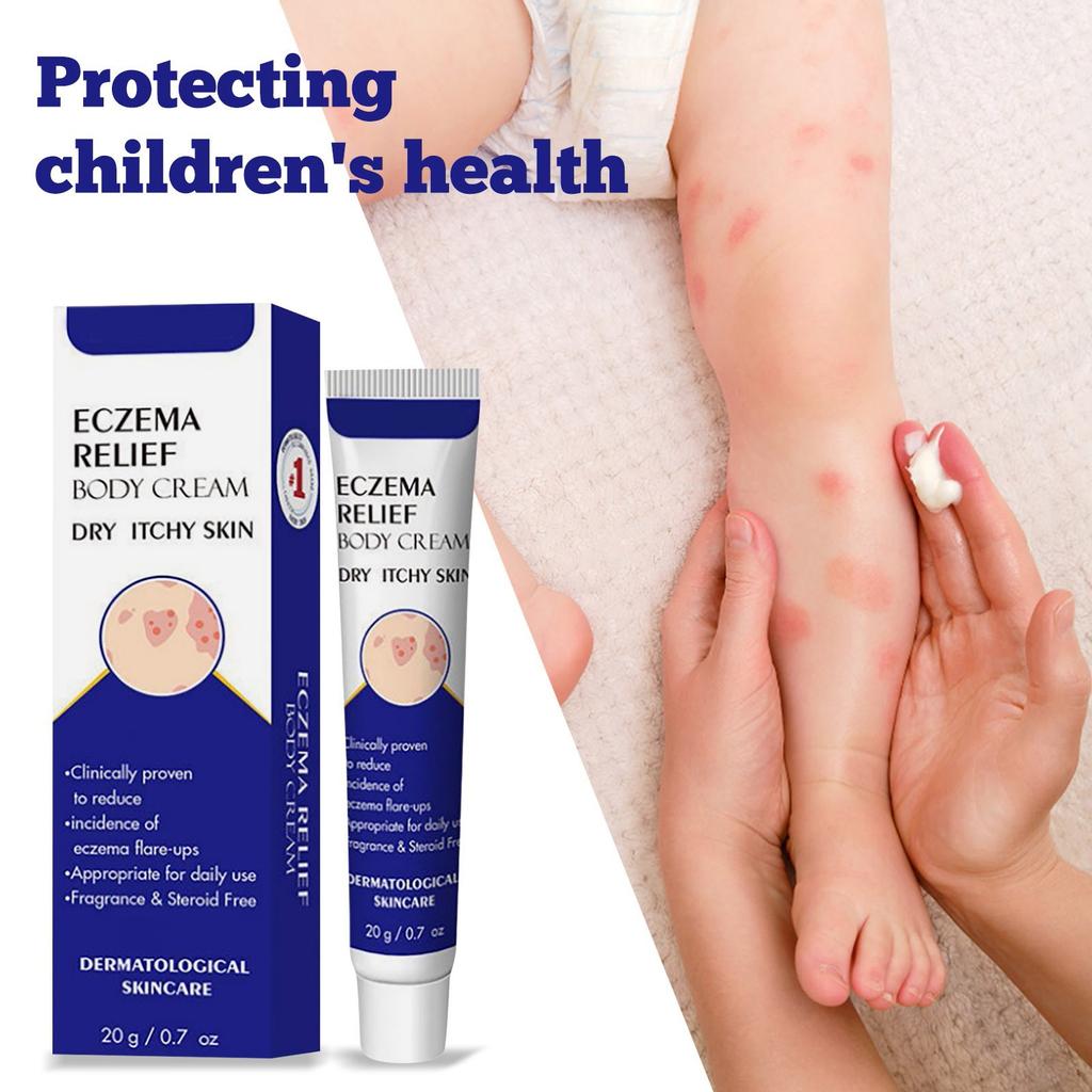 Eczema Cream 20g, Itch And Fungal Cream, Skin Care Cream For Relieving Itching And Soothing The Skin