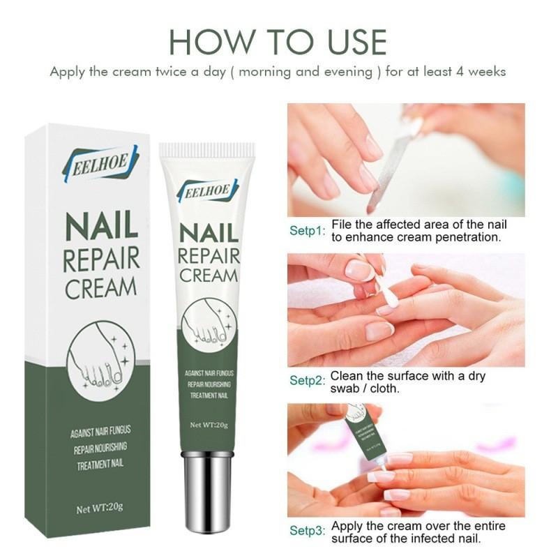 Crème de Réparation pour Ongles pour des Ongles Sains et Forts et Soin Doux des Pieds 20g Pour le Traitement des Ongles Endommagés
