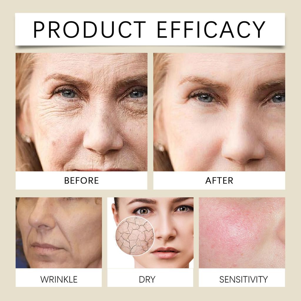 Hoygi Retinol Moisturizing Cream With Brightening And Hydrating Collagen Formula