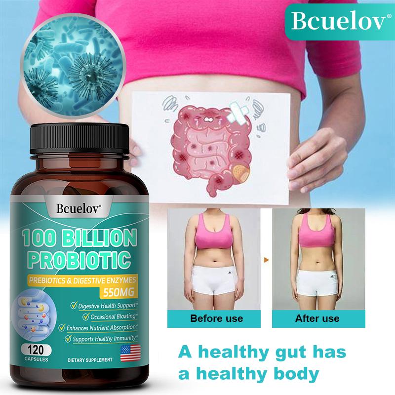 Bcuelov Probiotic Capsules with Digestive Enzymes Relieve Bloating Enhance Nutrient Absorption 120 Capsules