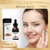 Melanin Correcting Serum Fade Dark Spots Anti Freckle Melasma Remover Lightening Pigment Blemish Vitamin C Face Essence