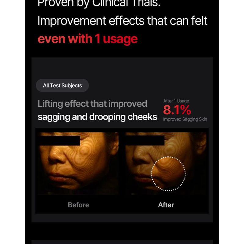 Meditherapy Shumage Gold Seal Lifting Cream & EMS Device Set