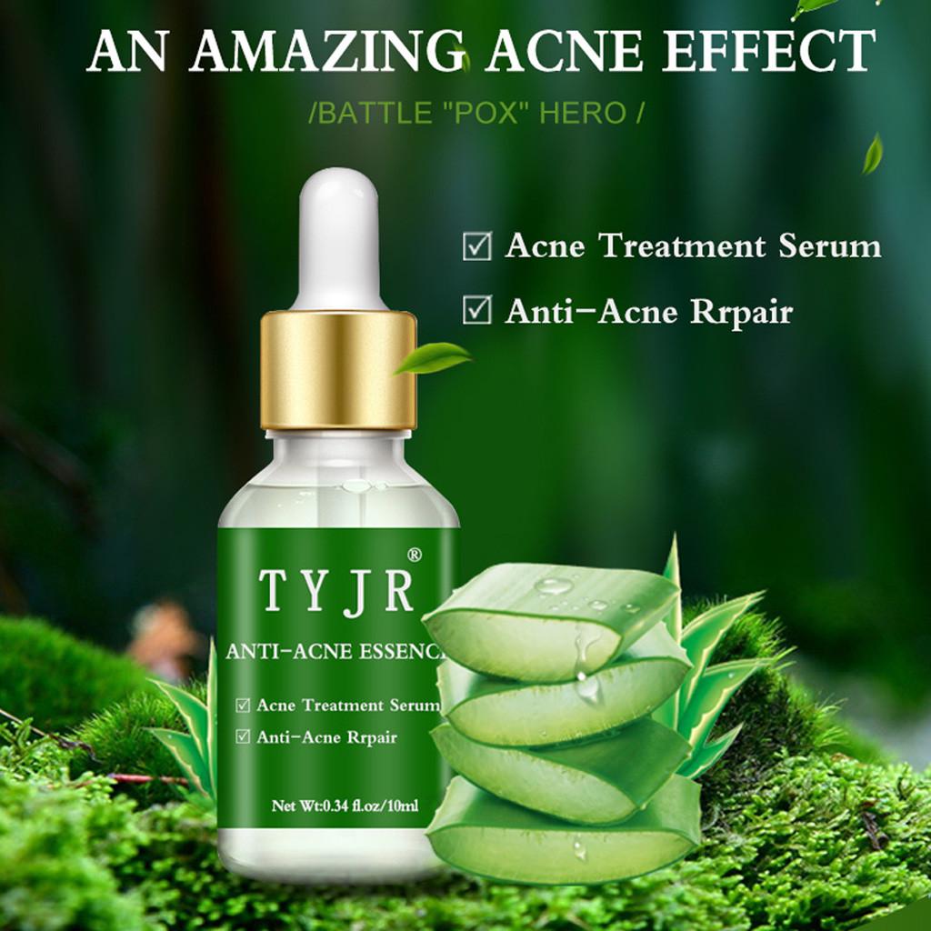 

Aloe Oil Anti-wrinkle Extract Acne Removal Marks