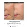 DEPOLOGY MATRIXYL 3000 Collagen Serum 1.01 Fl.oz 30ml X 2
