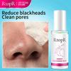 Blackheads Whiteheads Mask Liquid Blackheads Closed Mouth Whiteheads Export Liquid Deep Cleansing Pores