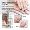 Jaysuing 7 Days Nail Repair Essence Element Repair Ingrown Nail Thickening Gray Nail Hand Foot Nail Repair Liquid