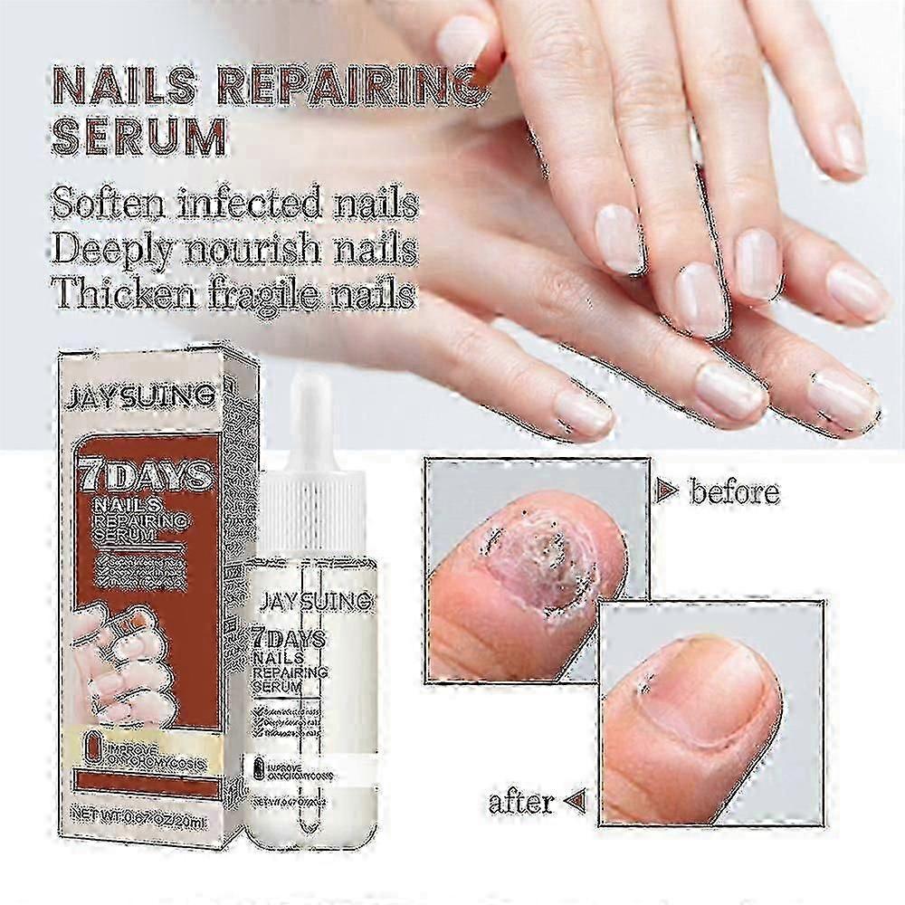 Jaysuing 7 Days Nail Repair Essence Element Repair Ingrown Nail Thickening Gray Nail Hand Foot Nail Repair Liquid