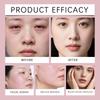 Cold And Hot Dual-purpose Facial Roller Massager, Alloy Constant Temperature, Swelling Reduction And Circulation Portable Massager.