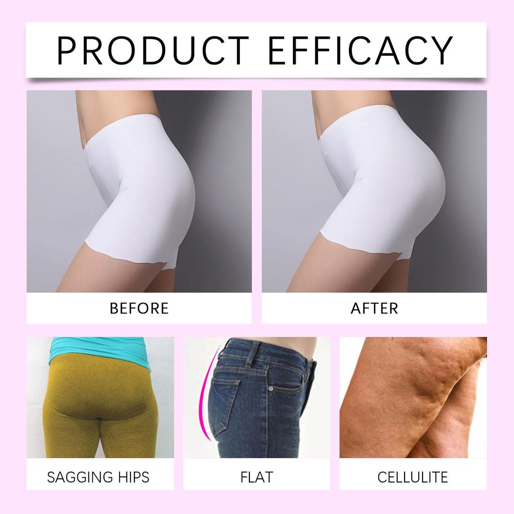 Buttock Firming Cream Improves Sagging, Smoothens Roughness, Shapes Lines And Nourishes The Skin. Buttock Care Cream.