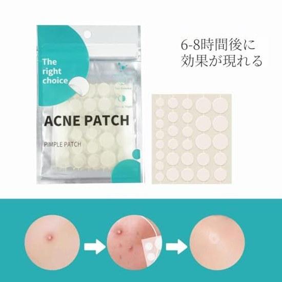 Acne Patch Hydrocolloid That Covers Face Invisible Spot Suitable All Skin Types (150 Pieces)