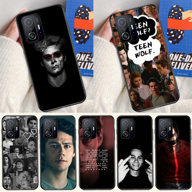 Dylan O'Brien Teen Wolf Case For Xiaomi 14 13 15 Ultra 11T 12T 13T 14T Pro POCO X7 Pro X3 X5 F5 F6 M6 X6 Pro Cover