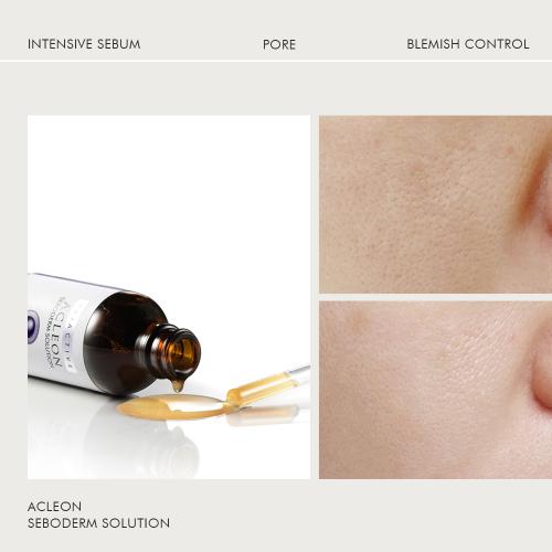 Akleon Sebo-Derm Solution Acne Oily Skin Pore Antioxidant Ampoule 55ml