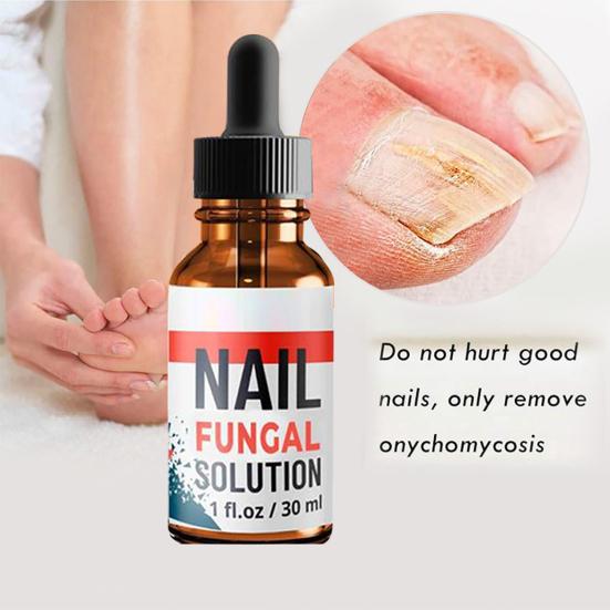 10ml/20ml/30ml Anti Fungus Liquid Toe Finger Nail Infection Repair Treatment