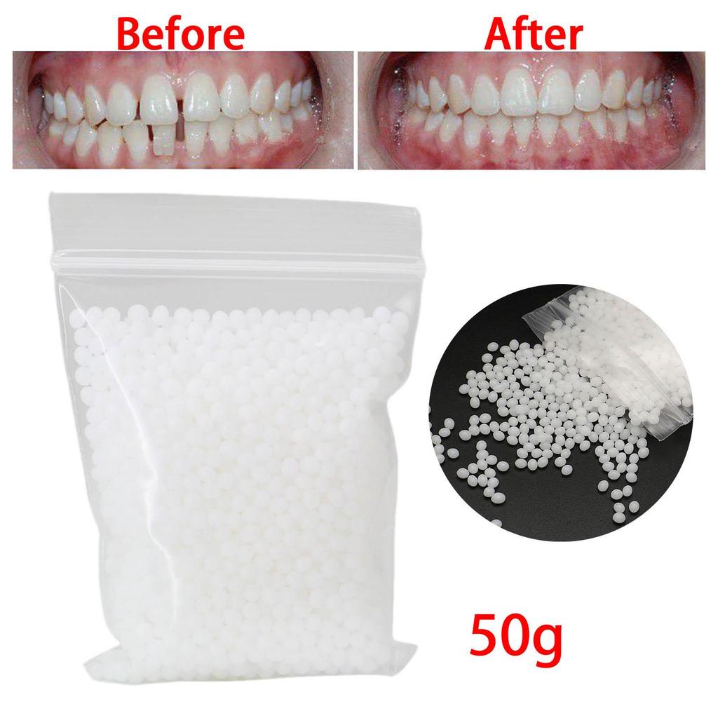 50G Temporary Tooth Repair Kit Adhesive Beads Moldable Fake Teeth Veneer2027