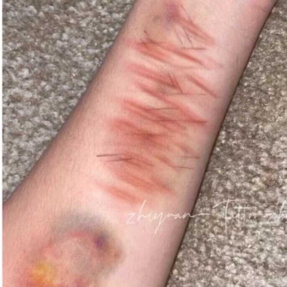 Wound Makeup Sticker, Scar-shaped Sticker, Bruise Tattoo, 10 Pieces, 10 Scar Photos