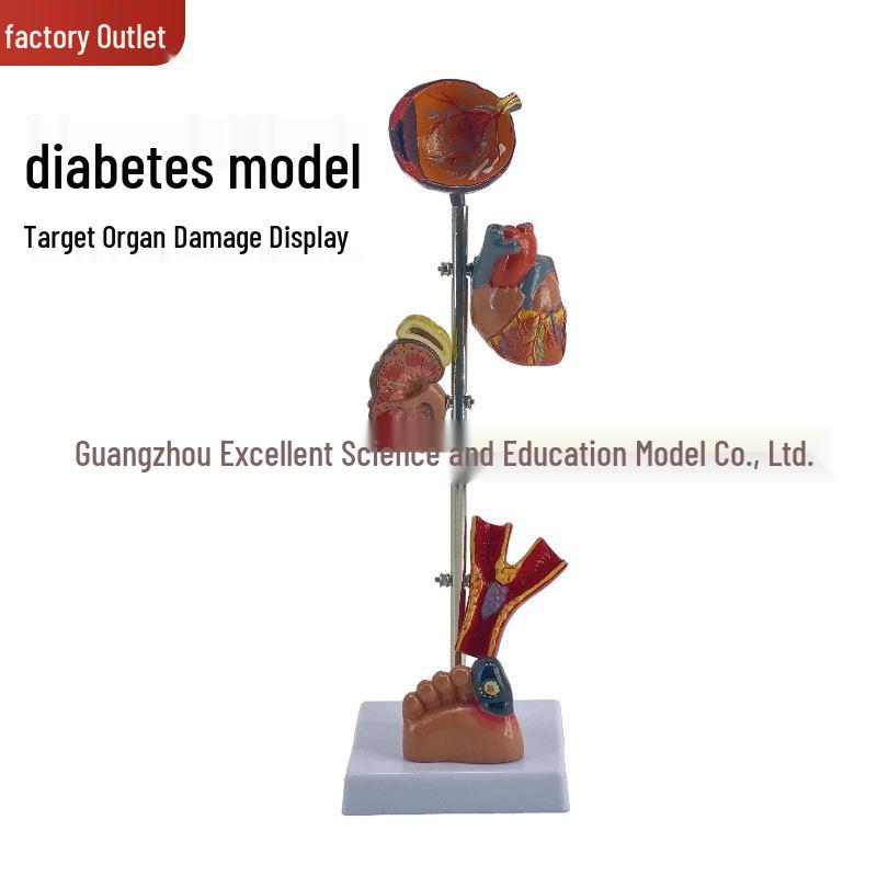 Diabetes Complication and Pathology Organ Model