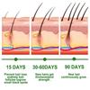 2 Pcs Rosemary Oil For Hair Growth, Rosemary Essential Oil For Hair Growth & Skin Care,improve Hair Loss
