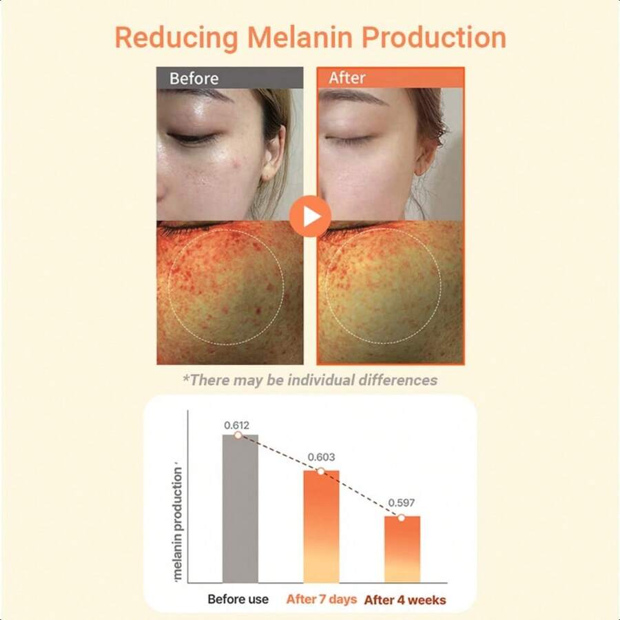 heimish RX Multi Vitamin Dark Spot Cream 50ml- Brightening Cream For Dark Spot & Hyperpigmentation Reduction, Face Moisturizer, Hydrating