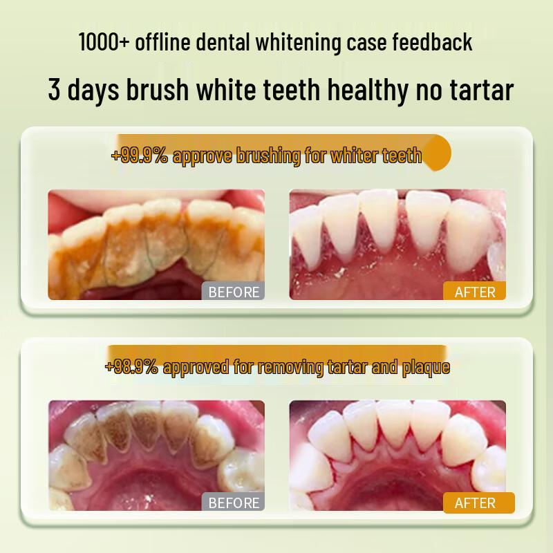 LOSMVFCEE German Whitening Fluoride Toothpaste