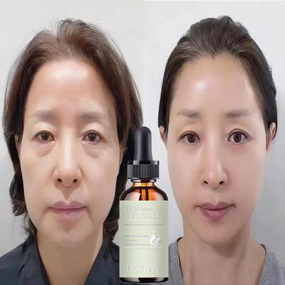 Super Vitamin C Serum Anti-Aging Whitening Serum Öl Gesichtsserum Zeitloses Gesichtsserum Anti-Falten für das Gesicht Dunkle Flecken