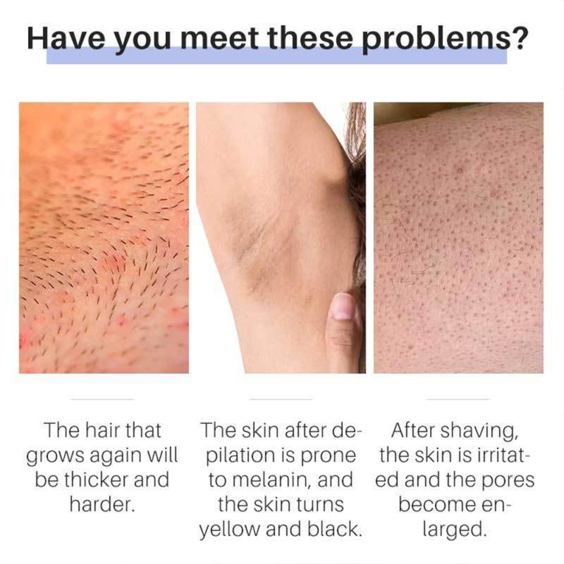 Inhibitor de creștere a părului Loțiune de corp pentru suprimarea părului Îndepărtare eficientă fără durere Hidratare