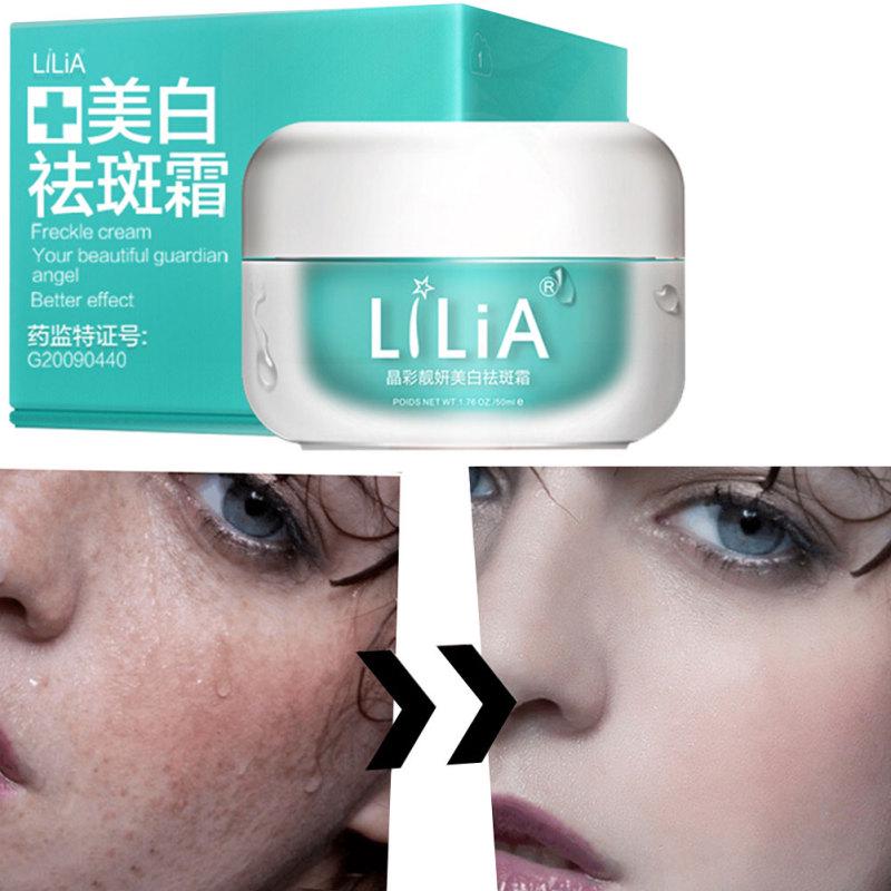 Herbal Whitening Freckle Cream Moisturizing Remove Melasma Acne Spots Melanin Dark Spots Face Care
