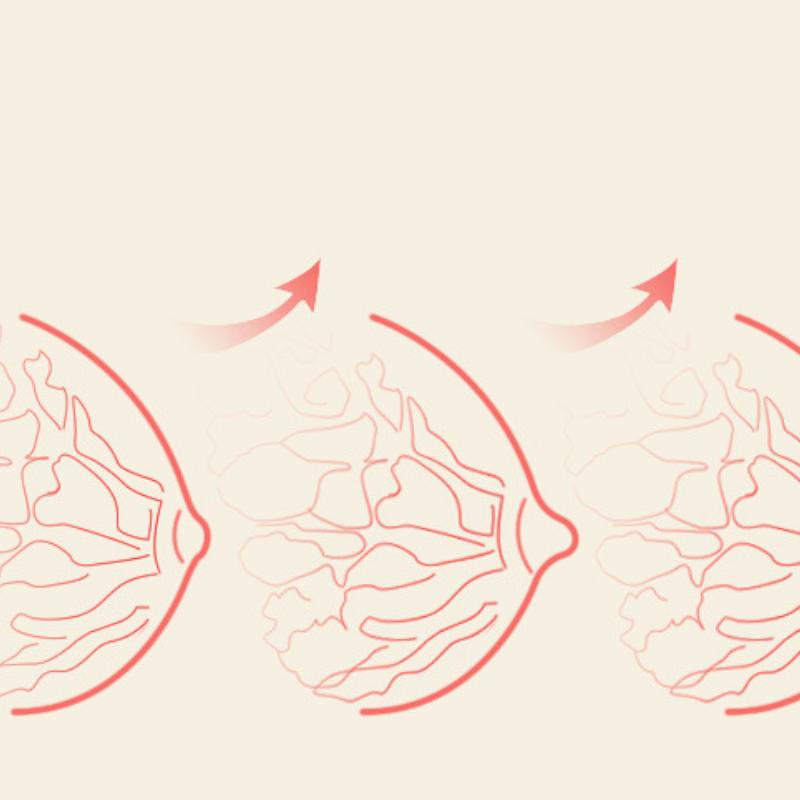 Θηλές σιλικόνης Orthotics Teenage Nipples Inverted Retractor Nipples Inverted Flat Suctioners