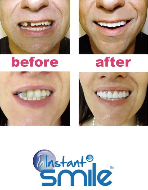 Zâmbet Instant Mărime M Articol Unic (Zâmbet Instantaneu)