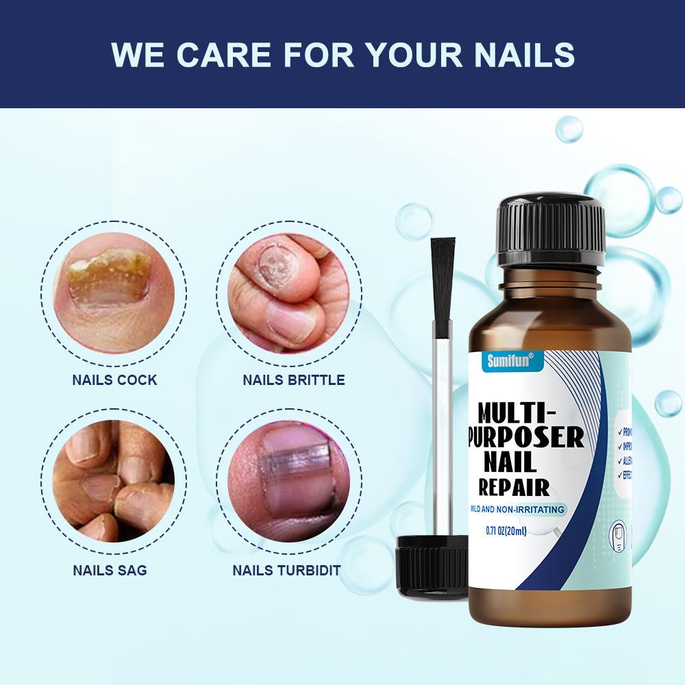 Gray Nail Paste, Thickened Shiny Nail, Gray Nail Repairs, Clean and Soft Nail Paste, Care for Hand, Foot and Toenail Decay