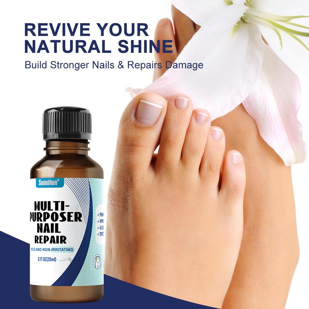 Gray Nail Paste, Thickened Shiny Nail, Gray Nail Repairs, Clean and Soft Nail Paste, Care for Hand, Foot and Toenail Decay