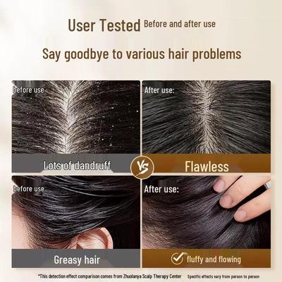 Zhuolanya Ingweröl Kontrolle Volumen Shampoo