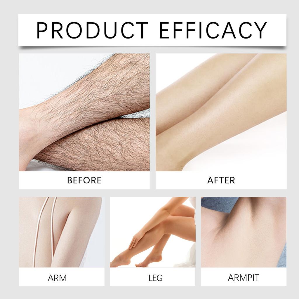 Body Gentle Hair Removal Cream  Quick Hair Removal Without Irritating Hair Removal  Smooth Skin Hair Removal Cream