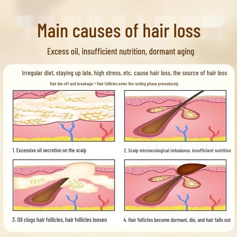 

Nanjing Tong Ren Tang Anti-Hair Loss & Growth Ginger Shampoo